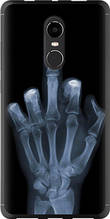 Чохол на Xiaomi Redmi Note 4X Рука через рентген "1007u-951-851"