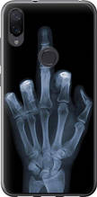 Чохол на Xiaomi Mi Play Рука через рентген "1007u-1644-851"