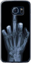 Чохол на Samsung Galaxy S6 G920 Рука через рентген "1007u-80-851"