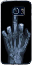 Чохол на Samsung Galaxy S6 Edge G925F Рука через рентген "1007u-83-851"