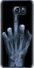 Чохол на Samsung Galaxy Note 5 N920C Рука через рентген "1007u-127-851"