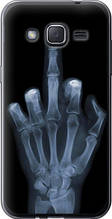 Чохол на Samsung Galaxy J2 J200H Рука через рентген "1007u-190-851"