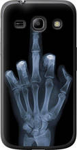 Чохол на Samsung Galaxy Star Advance G350E Рука через рентген "1007u-210-851"