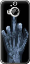 Чохол на HTC One M9 Plus Рука через рентген "1007u-134-851"
