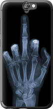 Чохол на HTC One A9 Рука через рентген "1007u-156-851"
