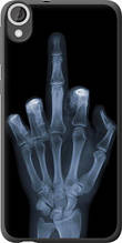 Чохол на HTC Desire 820 Рука через рентген "1007u-133-851"