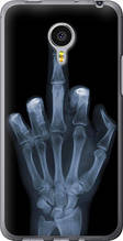 Чохол на Meizu MX4 PRO Рука через рентген "1007u-132-851"