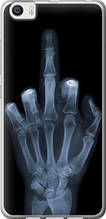 Чохол на Xiaomi Mi5 Рука через рентген "1007u-180-851"