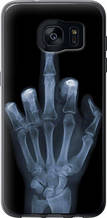 Чохол на Samsung Galaxy S7 Edge G935F Рука через рентген "1007u-257-851"