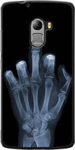 Чохол на Lenovo A7010 Рука через рентген "1007u-232-851"