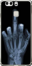 Чохол на Huawei P9 Plus Рука через рентген "1007u-300-851"