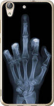 Чохол на Huawei Y6 II Рука через рентген "1007u-338-851"