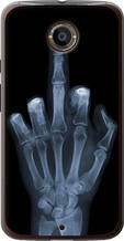 Чохол на Motorola Moto X2 Рука через рентген "1007u-372-851"