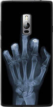 Чохол на OnePlus 2 Рука через рентген "1007u-386-851"