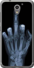 Чохол на ZTE A510 Рука через рентген "1007u-432-851"