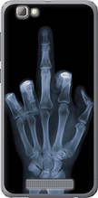 Чохол на ZTE A610 Рука через рентген "1007u-433-851"