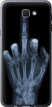 Чохол на Samsung Galaxy J5 Prime Рука через рентген "1007u-465-851"