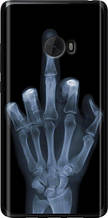 Чохол на Xiaomi Mi Note 2 Рука через рентген "1007u-422-851"