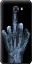 Чохол на Samsung Galaxy C9 Pro Рука через рентген "1007u-720-851"