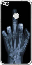 Чохол на Huawei P8 Lite (2017) Рука через рентген "1007u-777-851"