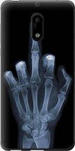 Чохол на Nokia 6 Рука через рентген "1007u-898-851"
