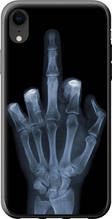 Чохол на iPhone XR Рука через рентген "1007u-1560-851"