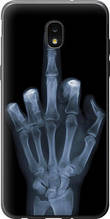 Чохол на Samsung Galaxy J7 2018 Рука через рентген "1007u-1502-851"