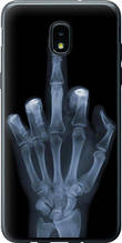 Чохол на Samsung Galaxy J3 2018 Рука через рентген "1007u-1501-851"