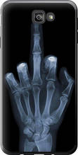 Чохол на Samsung Galaxy J7 Prime Рука через рентген "1007u-610-851"