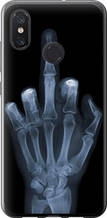 Чохол на Xiaomi Mi8 Рука через рентген "1007u-1499-851"