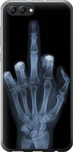 Чохол на Huawei Honor V10 / View 10 Рука через рентген "1007u-1579-851"