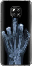 Чохол на Huawei Mate 20 Pro Рука через рентген "1007u-1567-851"