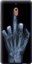Чохол на Nokia 2.1 Рука через рентген "1007u-1532-851"