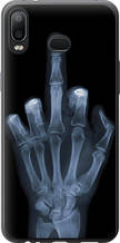 Чохол на Samsung Galaxy A6s Рука через рентген "1007u-1604-851"