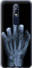 Чохол на Nokia 7.1 Рука через рентген "1007u-1593-851"