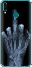 Чохол на Huawei Y9 2019 Рука через рентген "1007u-1602-851"