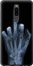 Чохол на Meizu Note 8 Рука через рентген "1007u-1610-851"
