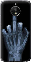 Чохол на Motorola Moto E4 Plus Рука через рентген "1007u-1000-851"