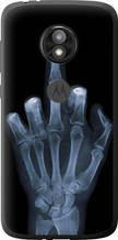 Чохол на Motorola Moto E5 Play Рука через рентген "1007u-1429-851"