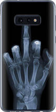 Чохол на Samsung Galaxy S10e Рука через рентген "1007u-1646-851"