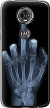 Чохол на Motorola Moto E5 Plus Рука через рентген "1007u-1412-851"