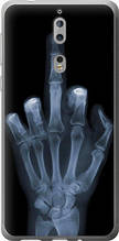 Чохол на Nokia 8 Рука через рентген "1007u-1115-851"