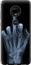Чохол на Motorola Moto G7 Рука через рентген "1007u-1614-851"