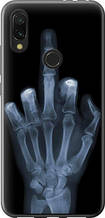 Чохол на Xiaomi Redmi 7 Рука через рентген "1007u-1669-851"