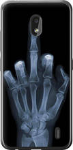 Чохол на Nokia 2.2 Рука через рентген "1007u-1706-851"