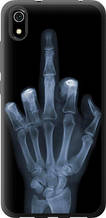 Чохол на Xiaomi Redmi 7A Рука через рентген "1007u-1716-851"