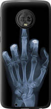 Чохол на Motorola Moto G6 Рука через рентген "1007u-982-851"