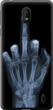 Чохол на Nokia 1 Plus Рука через рентген "1007u-1677-851"