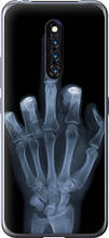 Чохол на Vivo X27 Pro Рука через рентген "1007u-1772-851"