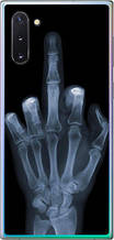 Чохол на Samsung Galaxy Note 10 Рука через рентген "1007u-1718-851"